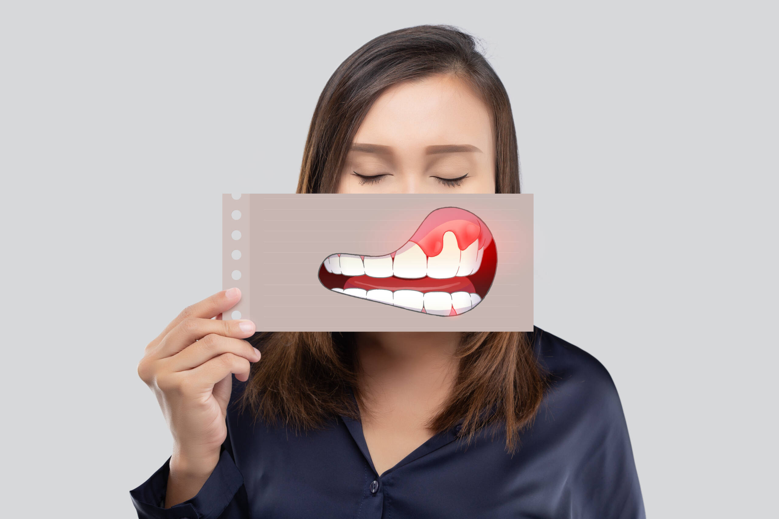 Gum treatments