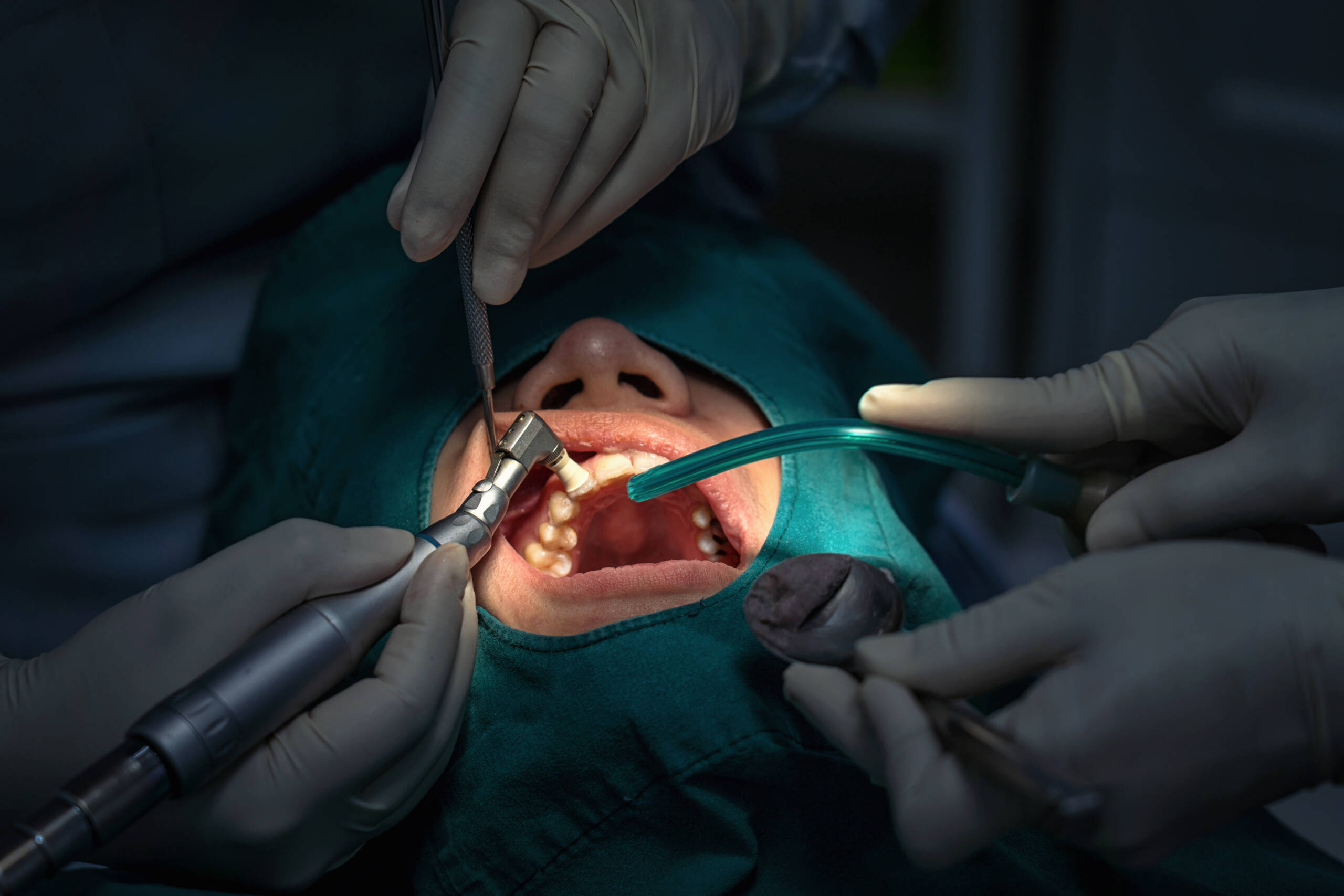 Oral Surgery