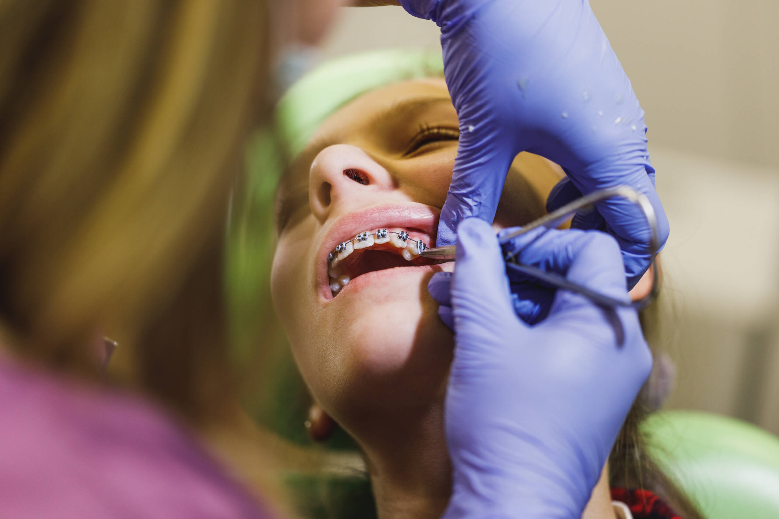 Orthodontic Treatment
